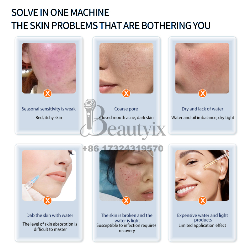 最新のハローフェイス3高圧エアフロー保湿フェイシャルマシン  - Skincare Ls のレビューと価格